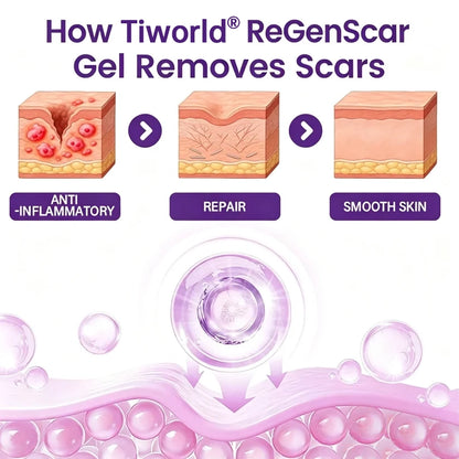 Tiworld® ReGenScar Stem Cell Scar Gel