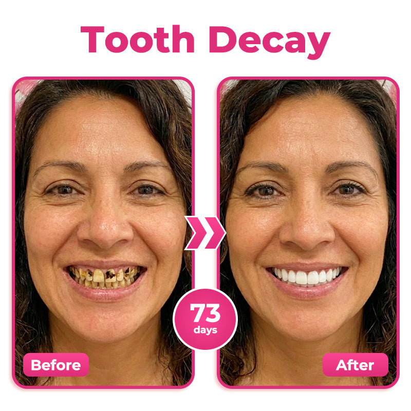 Tiworld®NH-10 Enamel & Gum Advanced Therapy Toothpaste Serum