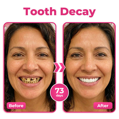 Tiworld®NH-10 Enamel & Gum Advanced Therapy Toothpaste Serum