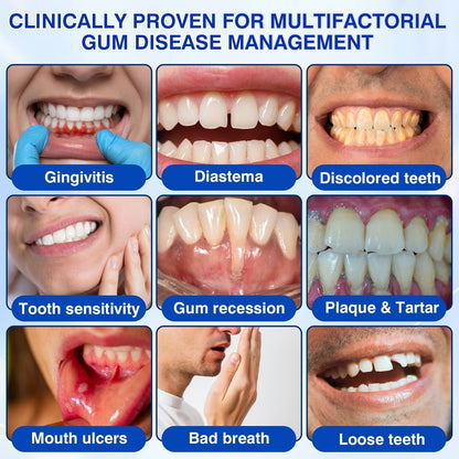 👨‍⚕️🦷🛡️Tiworld ® Gum health Periodontal Repair Gel