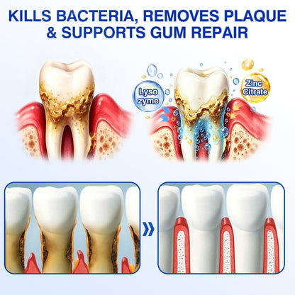 👨‍⚕️🦷🛡️Tiworld ® Gum health Periodontal Repair Gel