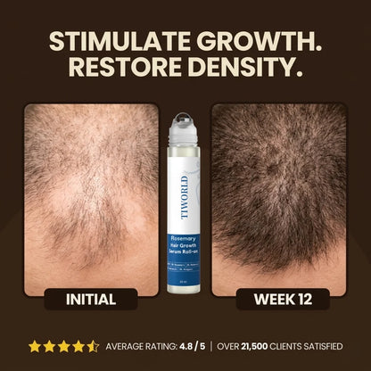 Tiworld Hair Growth Roll On Serum