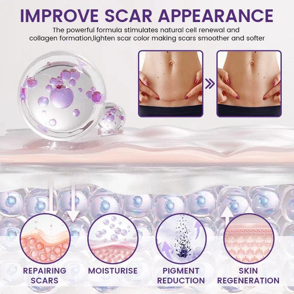 Tiworld® ReGenScar Stem Cell Scar Gel