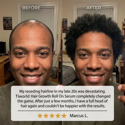 Tiworld Hair Growth Roll On Serum