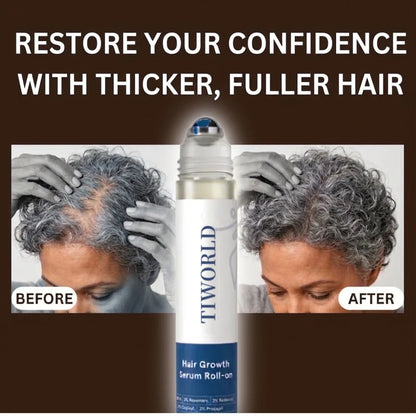 Tiworld Hair Growth Roll On Serum