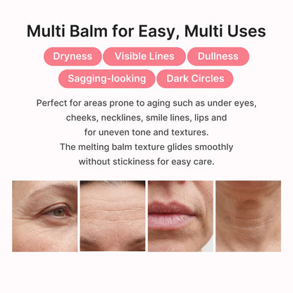 Target Neck Lines, Crepey Skin & Loss of Firmness.