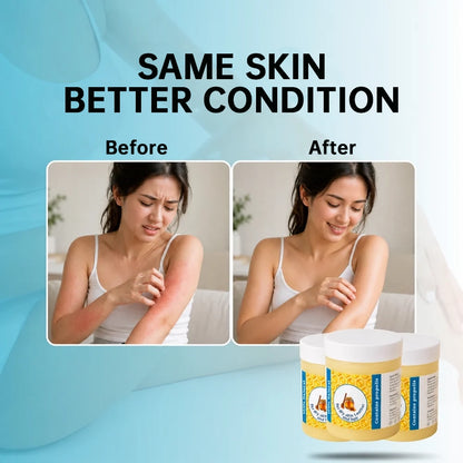 Calming & Restorative Soothing Cream Formulated with Premium Propolis Extract📈