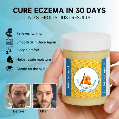 Calming & Restorative Soothing Cream Formulated with Premium Propolis Extract📈