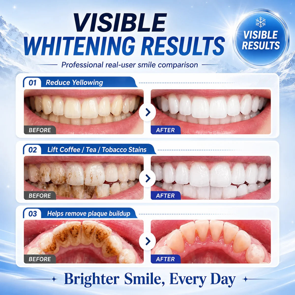 Visible whitening results showing before-and-after teeth comparisons